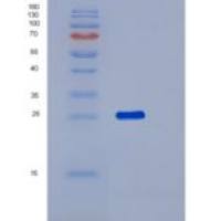 人吡哆胺-5'-磷酸氧化酶(PNPO)重组蛋白