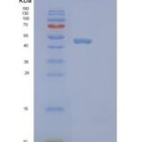 人蛋白激酶C相互作用蛋白1(PICK1)重组蛋白
