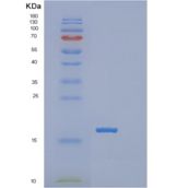 人POLR2I重组蛋白