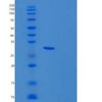 人磷脂爬行酶3(PLSCR3)重组蛋白