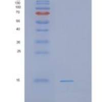 人PHF5A重组蛋白