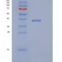 人PINX1重组蛋白