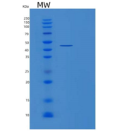 人磷酸甘油酸酯激酶1(PGK1)重组蛋白