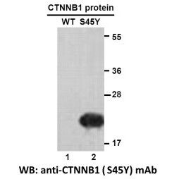 CTNNB1(S45Y) 