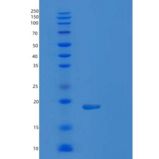 大鼠抑丝蛋白1(PFN1)重组蛋白