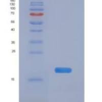 人前折叠蛋白亚基1(PFDN1)重组蛋白