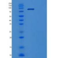 人PNPT1重组蛋白