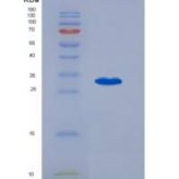人阿黑皮素原(POMC)重组蛋白