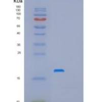 人前折叠蛋白亚基4(PFDN4)重组蛋白