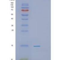 人磷酸组氨酸性磷酸酶1(PHPT1)重组蛋白