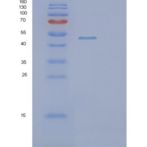 人PIP4K2B重组蛋白