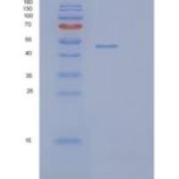 人PIP4K2B重组蛋白