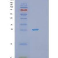 人磷酸丝氨酸磷酸酶重组蛋白