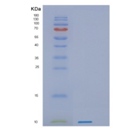 人蛋白激酶抑制因子β(PKIb)重组蛋白