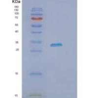 人PHOSPHO1重组蛋白