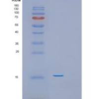 人前折叠蛋白亚基6(PFDN6)重组蛋白