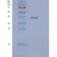 人PIH1D2重组蛋白