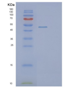 人PIP4K2B重组蛋白