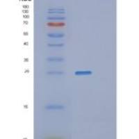 人PGP9.5重组蛋白