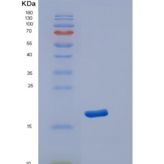 人DNA指导的RNA聚合酶II亚单位RP B4（POLR2D）重组蛋白