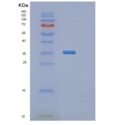 人渗透性糖蛋白(Pgp)重组蛋白