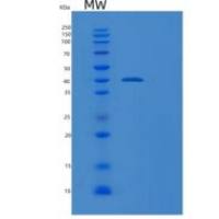 人胃蛋白酶原C(PGC)重组蛋白