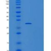 人PLEKHF2重组蛋白