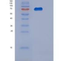 人葡萄糖磷酸变位酶(PGM2)重组蛋白