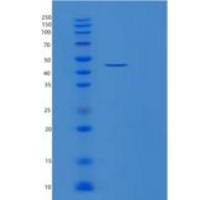 人磷酸甘油酸酯激酶1(PGK1)重组蛋白