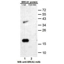 BRCA1 (1-120)