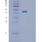人PLA1A重组蛋白