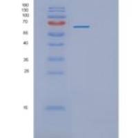 人血小板内皮细胞粘附分子重组蛋白