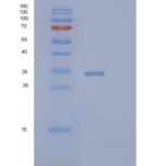 人Pirin蛋白(PIR)重组蛋白