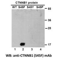 CTNNB1(S45F)