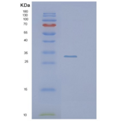 人Pim-1原癌基因(PIM1)重组蛋白