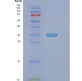 人Pim-2原癌基因(PIM2)重组蛋白