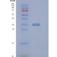 人Pim-2原癌基因(PIM2)重组蛋白