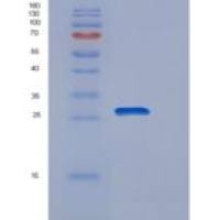 人POLR2E重组蛋白