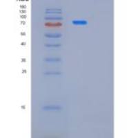 人肌肉磷酸果糖激酶(PFKM)重组蛋白