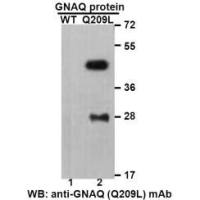 Gαq(Q209L)