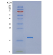 人POLR2I重组蛋白