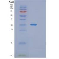 人渗透性糖蛋白(Pgp)重组蛋白