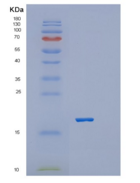 小鼠血小板受体Gi24重组蛋白