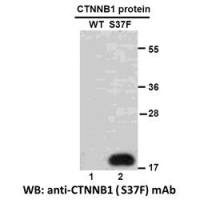CTNNB1(S37F)