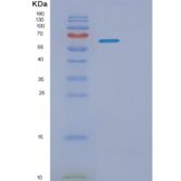 人PKM2重组蛋白