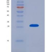 人蛋白酶体亚基α7(PSMa7)重组蛋白
