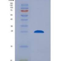 人催乳素(PRL)重组蛋白
