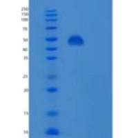 人非ATP酶蛋白酶体26S亚基11(PSMD11)重组蛋白
