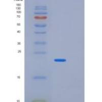 人蛋白磷酸酶3调节因子亚基2(PPP3R2)重组蛋白