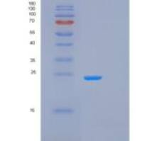 小鼠过氧化还原酶1(PRDX1)重组蛋白